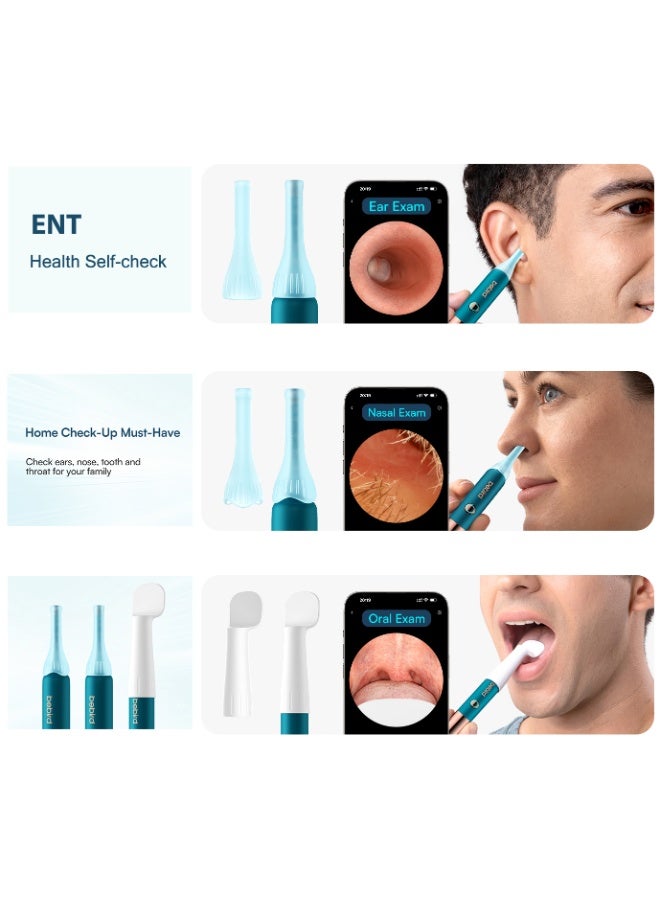 Bebird EarSight Ultra Smart Visual Earwax Removal Kit – 2K HD Medical-Grade Endoscopic Ear Camera with 5G WiFi, 3.6mm Flexible Silicone Tool, 60+ Pieces for Safe Ear Cleaning, ENT Health Check, & Facial Care for Adults, Kids, Infants & Elderly – USB-C Rechargeable Home Ear Care Device - Image 2